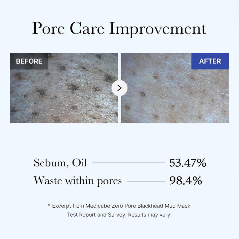 Zero Pore Blackhead Mud Mask
