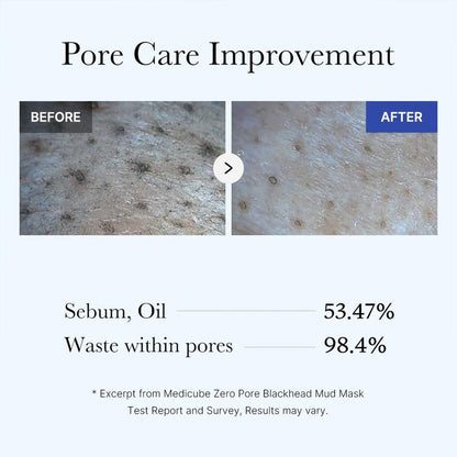 Zero Pore Blackhead Mud Mask