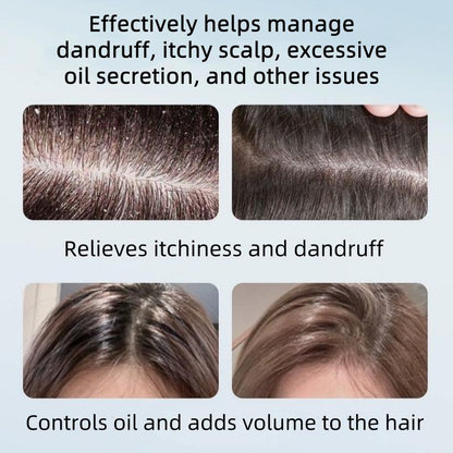 Anti-Dandruff Shampoo