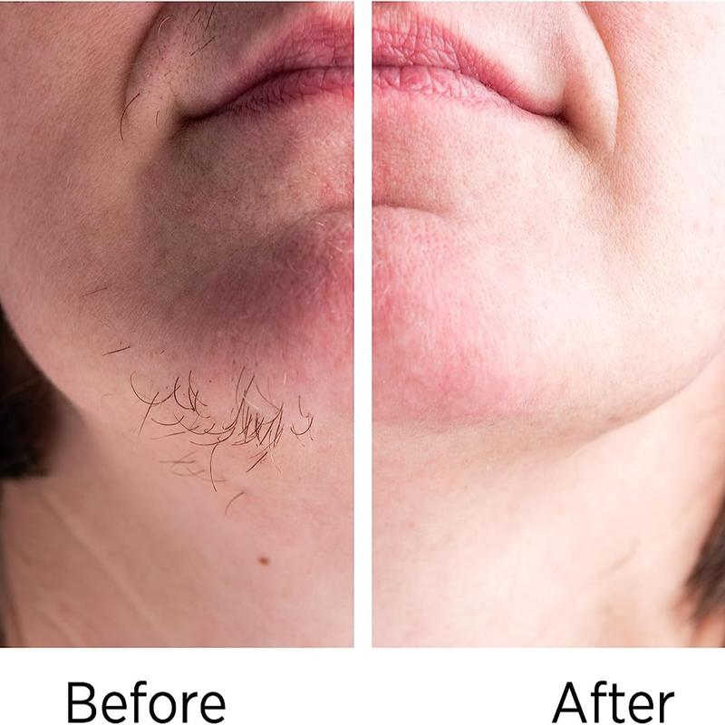 Facial Hair Remover